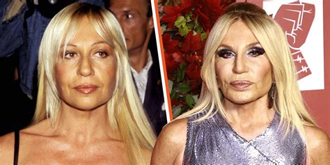 versace plastic surgery before and after|what happened to donatella Versace.